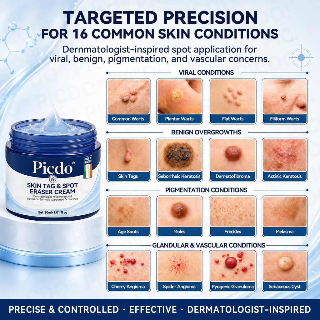 7-Day Skin Tag & Spot Eraser Cream — Gentle, Targeted Care for Smoother-Looking Skinc🌈