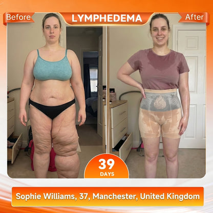 𝗣𝗔𝗨𝗥𝗔𝑱𝑼® 𝗠𝗼𝗿𝗶𝗻𝗴𝒂 & 𝗕𝗲𝗿𝗯𝗲𝗿𝗶𝗻𝒆 𝟰-𝗶𝗻-𝟭 𝗠𝗶𝗰𝗿𝒐-𝗣𝗮𝗿𝘁𝗶𝗰𝗹𝗲 𝗦𝗰𝘂𝗹𝗽𝘁𝗶𝗻𝗴 & 𝗙𝗮𝘁-𝑩𝒖𝒓𝒏 𝗦𝗵𝗼𝗿𝘁𝘀 ⚡ 𝗙𝗶𝗿𝗺 & 𝗦𝗵𝗮𝗽𝗲 𝗶𝗻 𝗝𝘂𝘀𝘁 𝟯𝟬 𝗠𝗶𝗻𝘂𝘁𝗲𝘀 ✨ 𝗨𝗽𝗴𝗿𝗮𝗱𝗲𝗱 𝟮𝟬𝟮𝟲 𝗘𝗱𝗶𝘁𝗶𝗼𝗻 💪